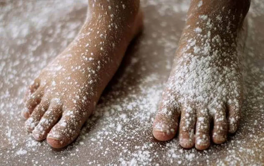 5 Natural Remedies To Treat Athlete’s Foot At Home, According To Podiatrists